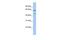 Lysosomal Associated Membrane Protein 3 antibody, PA5-42031, Invitrogen Antibodies, Western Blot image 