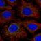 NADH:Ubiquinone Oxidoreductase Core Subunit S2 antibody, HPA055140, Atlas Antibodies, Immunofluorescence image 