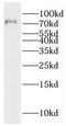 Rac GTPase-activating protein 1 antibody, FNab07070, FineTest, Western Blot image 