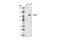 Toll Like Receptor 4 antibody, 2219S, Cell Signaling Technology, Western Blot image 