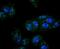 Inhibitor Of Nuclear Factor Kappa B Kinase Regulatory Subunit Gamma antibody, NBP2-66904, Novus Biologicals, Immunofluorescence image 