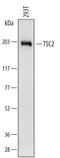 TSC Complex Subunit 2 antibody, AF4040, R&D Systems, Western Blot image 