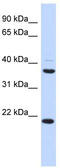 Transmembrane Protein 74 antibody, TA337856, Origene, Western Blot image 