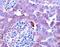 Inhibin Subunit Beta A antibody, PA5-47004, Invitrogen Antibodies, Immunohistochemistry paraffin image 