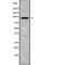 Colony Stimulating Factor 3 Receptor antibody, abx149576, Abbexa, Western Blot image 