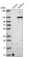 GTPase Activating Rap/RanGAP Domain Like 3 antibody, PA5-55970, Invitrogen Antibodies, Western Blot image 