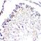 Stress Induced Phosphoprotein 1 antibody, GTX32900, GeneTex, Immunohistochemistry paraffin image 
