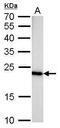 Lactoylglutathione lyase antibody, GTX628890, GeneTex, Western Blot image 