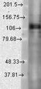 Potassium Voltage-Gated Channel Subfamily C Member 1 antibody, NBP2-12903, Novus Biologicals, Western Blot image 