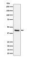 Interleukin 11 Receptor Subunit Alpha antibody, M06426, Boster Biological Technology, Western Blot image 