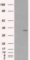 Protein Kinase CAMP-Dependent Type I Regulatory Subunit Alpha antibody, NBP1-47935, Novus Biologicals, Western Blot image 