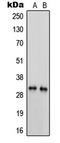 Serine Protease 3 antibody, LS-C352733, Lifespan Biosciences, Western Blot image 