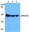 G Protein-Coupled Receptor 182 antibody, PA5-75662, Invitrogen Antibodies, Western Blot image 