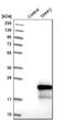 Tubulin Polymerization Promoting Protein Family Member 2 antibody, NBP1-88430, Novus Biologicals, Western Blot image 