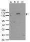 Poly(ADP-Ribose) Polymerase 1 antibody, LS-C109317, Lifespan Biosciences, Western Blot image 