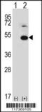 Thyroid Hormone Receptor Interactor 13 antibody, 61-545, ProSci, Western Blot image 