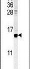 Cellular Retinoic Acid Binding Protein 1 antibody, PA5-25337, Invitrogen Antibodies, Western Blot image 