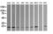 Ubiquitin Conjugating Enzyme E2 G2 antibody, M07427, Boster Biological Technology, Western Blot image 