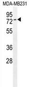 TCDD Inducible Poly(ADP-Ribose) Polymerase antibody, AP54260PU-N, Origene, Western Blot image 