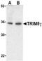 Tripartite Motif Containing 5 antibody, NBP1-76604, Novus Biologicals, Western Blot image 
