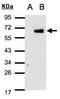 Interferon Regulatory Factor 6 antibody, PA5-28138, Invitrogen Antibodies, Western Blot image 