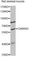 Gamma-Aminobutyric Acid Type A Receptor Alpha5 Subunit antibody, A13984, ABclonal Technology, Western Blot image 