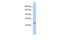 KIAA0319 Like antibody, GTX45967, GeneTex, Western Blot image 