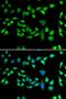 DnaJ Heat Shock Protein Family (Hsp40) Member B6 antibody, LS-C346206, Lifespan Biosciences, Immunofluorescence image 