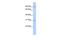 Cation Channel Sperm Associated Auxiliary Subunit Delta antibody, GTX45256, GeneTex, Western Blot image 