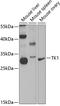 Thymidine Kinase 1 antibody, A04850, Boster Biological Technology, Western Blot image 