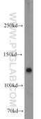 Cytoplasmic FMR1 Interacting Protein 2 antibody, 16011-1-AP, Proteintech Group, Western Blot image 