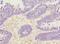 Peptidyl Arginine Deiminase 3 antibody, LS-C398265, Lifespan Biosciences, Immunohistochemistry frozen image 