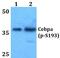 CCAAT Enhancer Binding Protein Alpha antibody, PA5-37342, Invitrogen Antibodies, Western Blot image 