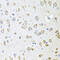 A-Kinase Anchoring Protein 5 antibody, abx005000, Abbexa, Western Blot image 