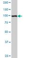 Zinc Finger E-Box Binding Homeobox 2 antibody, H00009839-M04, Novus Biologicals, Western Blot image 