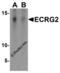 Serine Peptidase Inhibitor, Kazal Type 7 (Putative) antibody, 6523, ProSci, Western Blot image 