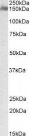 CUB And Sushi Multiple Domains 1 antibody, TA311554, Origene, Western Blot image 