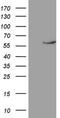 Nuclear Receptor Subfamily 1 Group D Member 2 antibody, NBP2-46219, Novus Biologicals, Western Blot image 