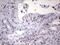NGFI-A Binding Protein 2 antibody, M02873, Boster Biological Technology, Immunohistochemistry paraffin image 