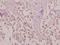 Lysophospholipase 1 antibody, A07249-1, Boster Biological Technology, Immunohistochemistry paraffin image 