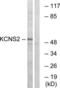 Potassium Voltage-Gated Channel Modifier Subfamily S Member 2 antibody, LS-C120238, Lifespan Biosciences, Western Blot image 