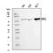 Kinesin Family Member C1 antibody, A05325-1, Boster Biological Technology, Western Blot image 