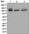 ATPase Sarcoplasmic/Endoplasmic Reticulum Ca2+ Transporting 2 antibody, ab137020, Abcam, Western Blot image 