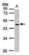 ERCC Excision Repair 8, CSA Ubiquitin Ligase Complex Subunit antibody, LS-C109290, Lifespan Biosciences, Western Blot image 