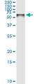 Stress Induced Phosphoprotein 1 antibody, LS-C133666, Lifespan Biosciences, Immunoprecipitation image 