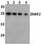 Zinc And Ring Finger 2 antibody, PA5-75935, Invitrogen Antibodies, Western Blot image 