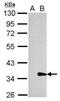 Galectin 8 antibody, GTX106821, GeneTex, Western Blot image 