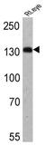 Hyperpolarization Activated Cyclic Nucleotide Gated Potassium Channel 4 antibody, GTX79454, GeneTex, Western Blot image 