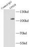 Vacuolar protein sorting-associated protein 18 homolog antibody, FNab09429, FineTest, Immunoprecipitation image 