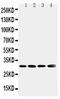 Superoxide Dismutase 3 antibody, LS-C313036, Lifespan Biosciences, Western Blot image 